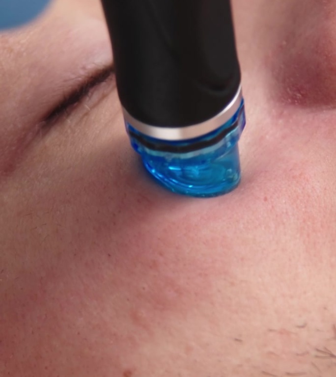 垂直视频。一名男子在美容诊所接受面部真空清洁，恢复活力，面部保湿程序。美与青春理念