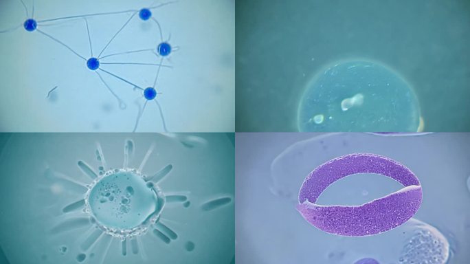 显微镜下癌细胞的分裂增值变化过程