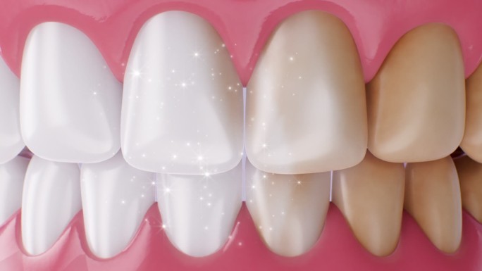 牙齿亮白