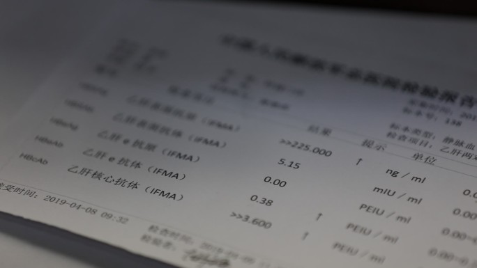 301医院 解放军总医院 乙肝化验单