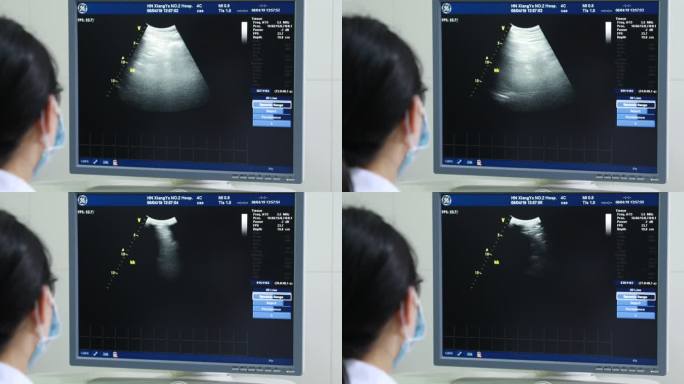 中南大学 湘雅二医院 超声科检查10