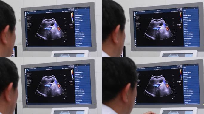 中南大学 湘雅二医院 超声科检查5