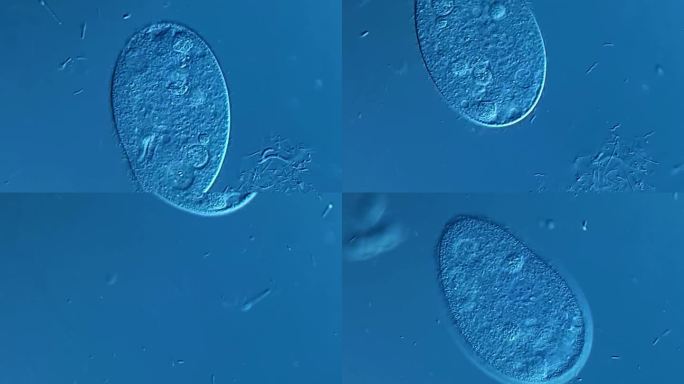 纤毛虫和细菌在显微镜下