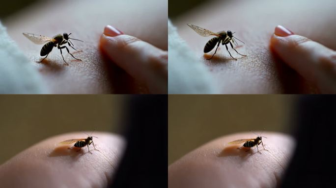 皮肤上蚊虫叮咬