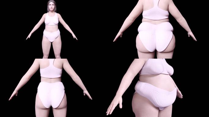 肥胖女性减肥
