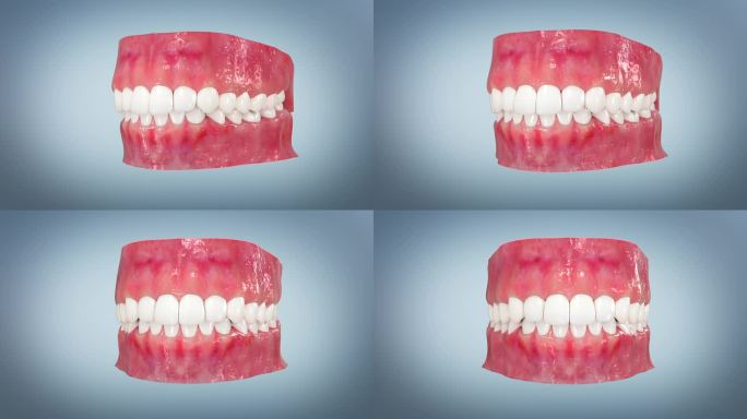 牙齿模型展示