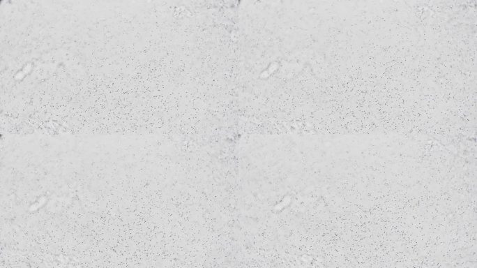 放大后的人类精子，100个精子在射精中快速游动