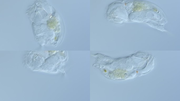 显微镜下的轮虫