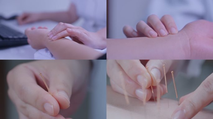 中医把脉针灸