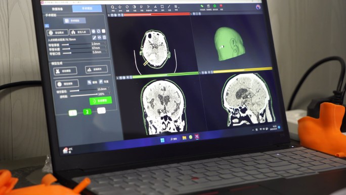 3D打印人脑模型 医学模型打印
