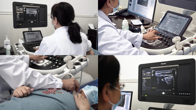 彩超 医生超声检查 医疗超声诊断操作