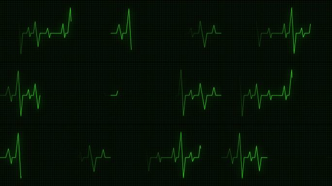 【AE模板】心电图动画-无缝循环
