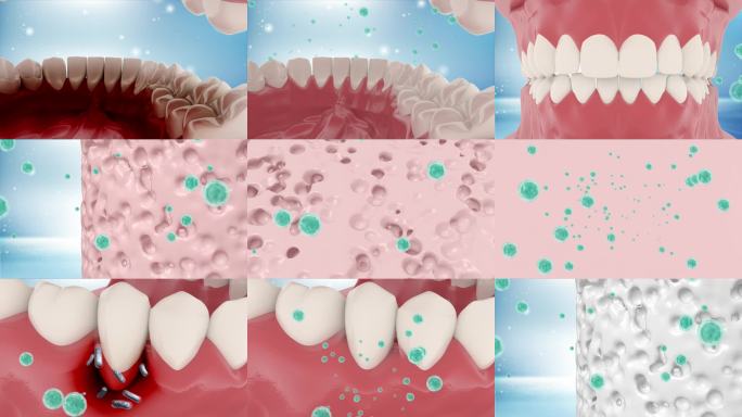 牙龈健康与病菌展示