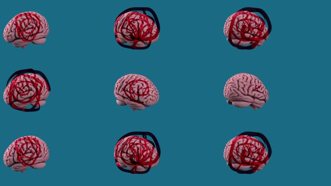 动画展示了大脑上的螺旋线条，象征着智力和心理问题。体现了障碍与寻找心理平衡的概念。
